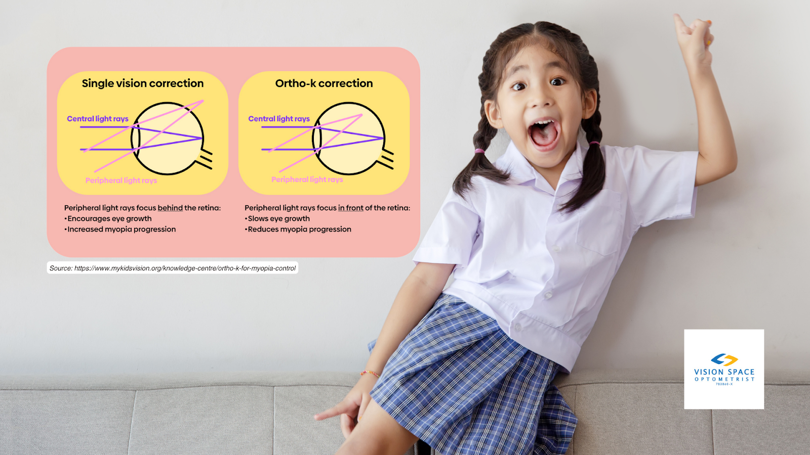 Ortho-k focuses peripheral light rays to focus in front of the retina, which is believed to act as a stop signal to eye growth, which slows progression of myopia. [Image Source: https://www.mykidsvision.org/knowledge-centre/ortho-k-for-myopia-control]