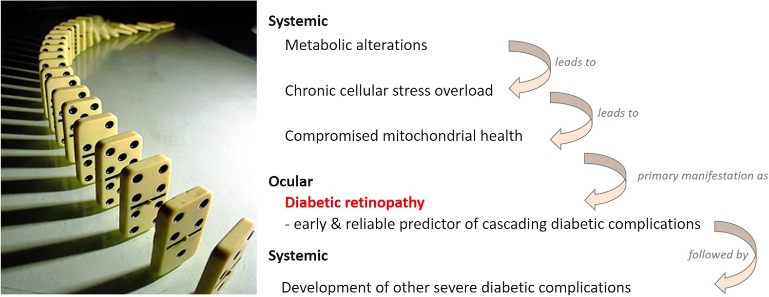 Diabetic retinopathy as the leading cause of blindness and early predictor of cascading complications—risks and mitigation. (Source: https://link.springer.com/article/10.1007/s13167-023-00314-8)